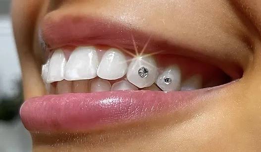 Teeth Jewellery